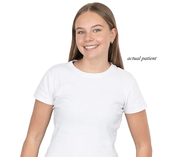 Orthodontic treatment Orthodontic treatment